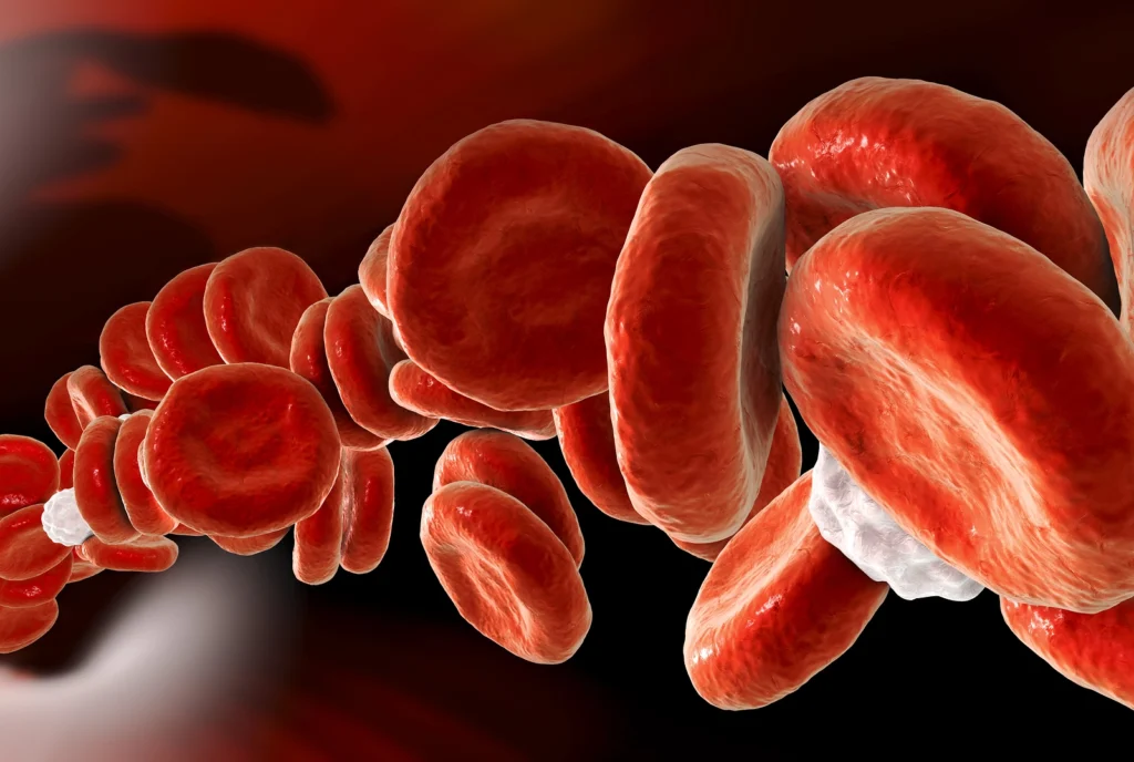 Exploring White Blood Cell Disorders: A Peek into Imbalances